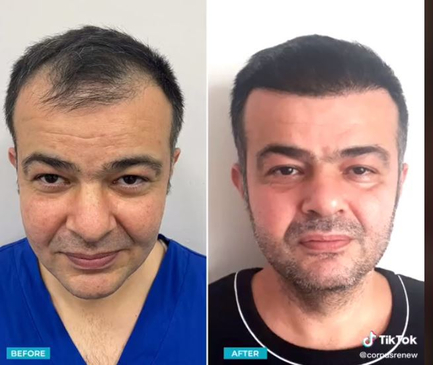 Slider image (3) CorpusRenew by Termessos Hospital